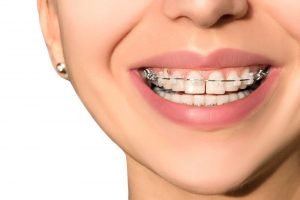 بهترین استاد ارتدنسی