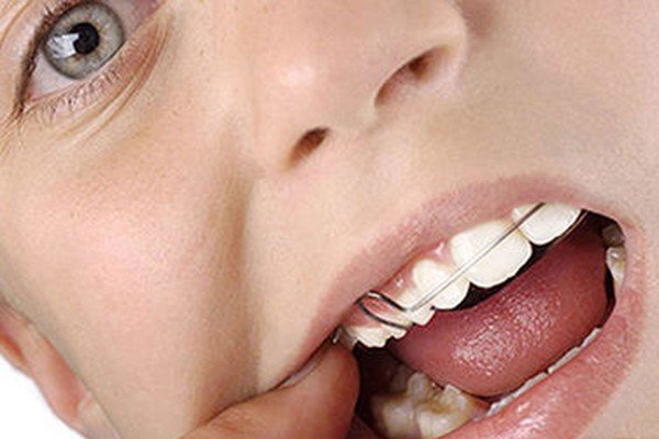 دانستنی‌های درباره اورژانس‌های ارتدنسی
