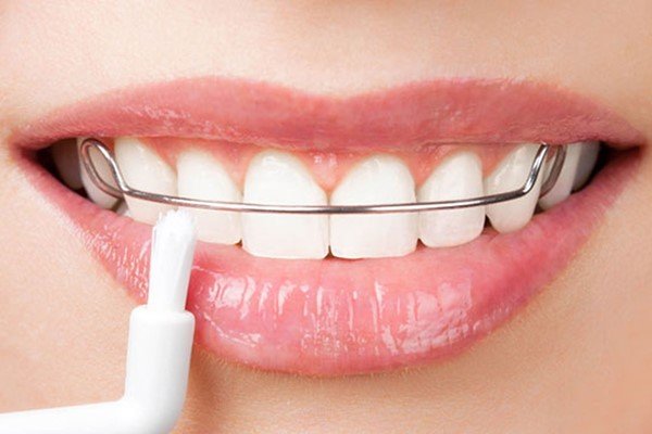 دانستنی‌های درباره اورژانس‌های ارتدنسی