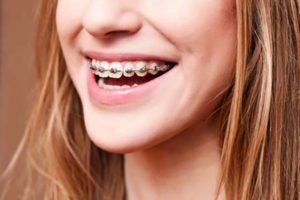 دانستنی‌های درباره اورژانس‌های ارتدنسی