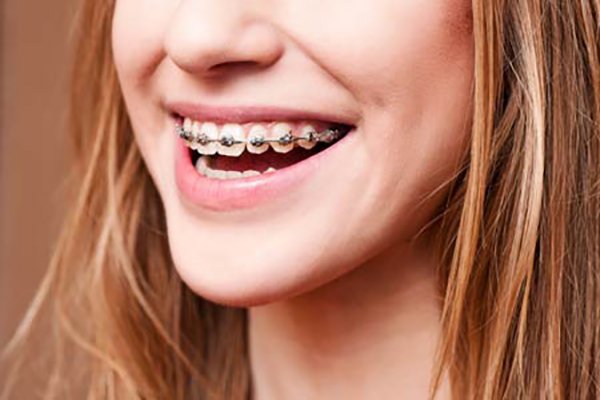 دانستنی‌های درباره اورژانس‌های ارتدنسی