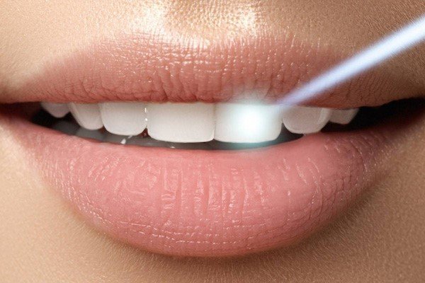 کاربردهای لیزر در درمان ارتدنسی چیست؟
